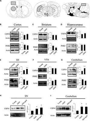 USP14 as a Therapeutic Target Against Neurodegeneration: A Rat Brain Perspective